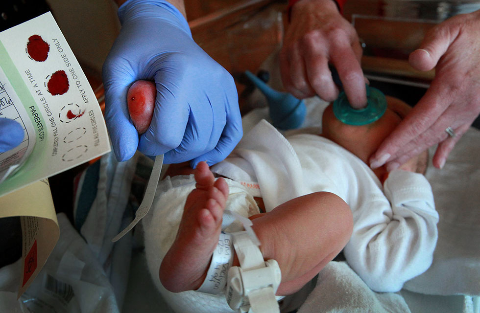 Newborn baby receiving medical treatment